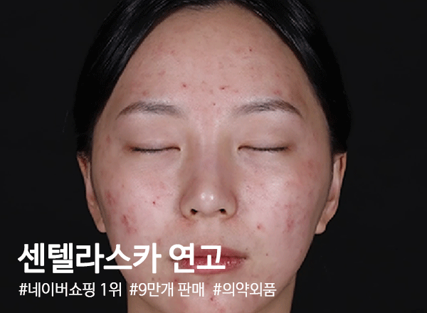 센텔라스카연고
